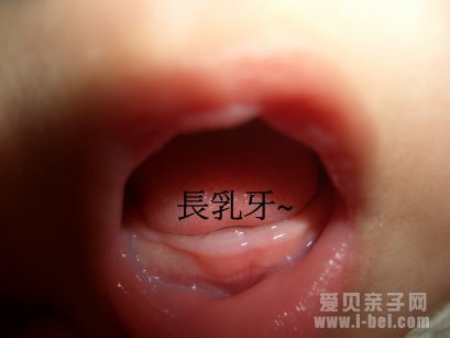 宝宝长牙慢的四大原因