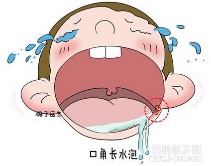 家长们注意了,宝宝三岁以上还流口水有可能是智力发育落后